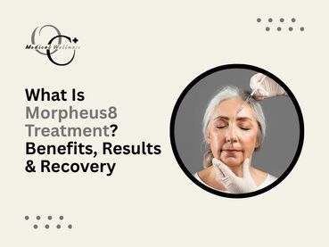 What Is Morpheus8 Treatment