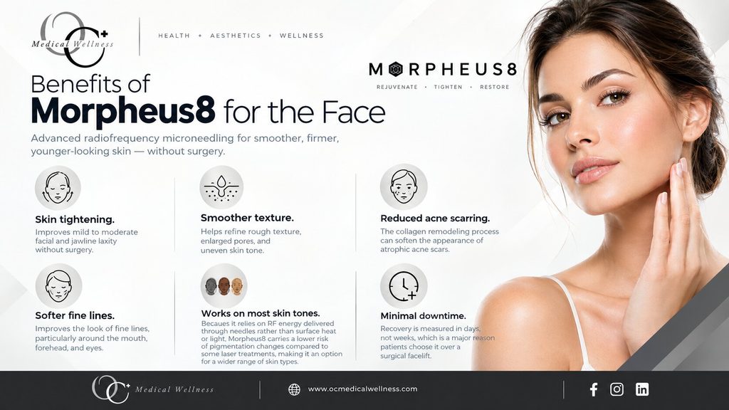 Benefits of Morpheus8 for the Face