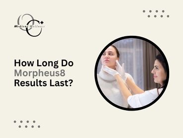 How Long Do Morpheus8 Results Last